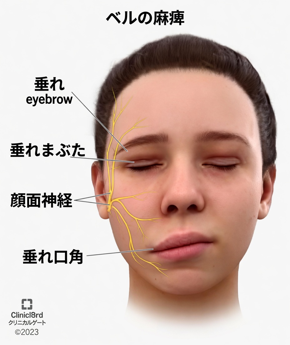 睡眠中の顔の変化が脳の健康リスクについて示すかもしれないこと
