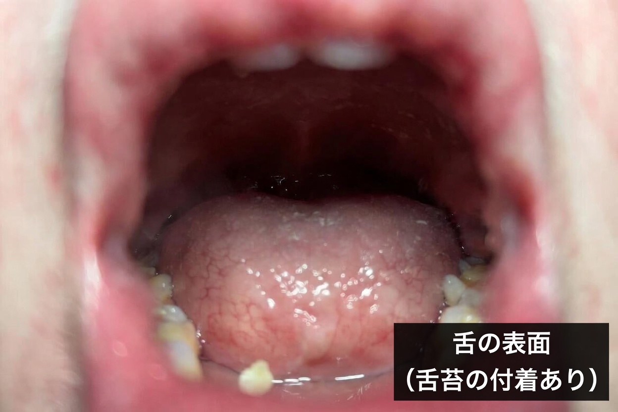 口臭の原因は、歯とはまったく関係ないかもしれない理由