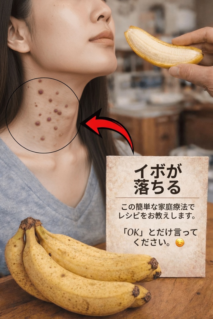 いぼにバナナの皮：人気の民間療法トレンドで本当にわかること