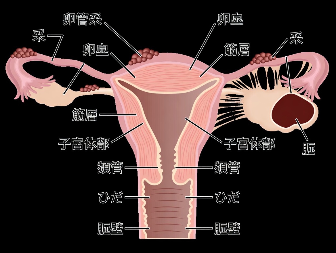 子宮内膜症の警告：見過ごしてはいけない日常の習慣