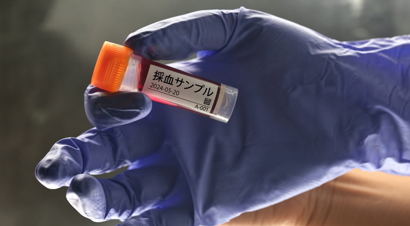 最新の研究で判明した、がんリスクの低下と関連している可能性のある血液型とは？