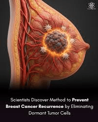 休眠腫瘍細胞の標的化と乳がん生存者における再発について、最近の臨床研究が明らかにしていること