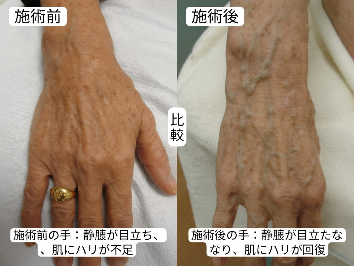 静脈瘤を解消し、血流を自然に改善する10の自然な方法