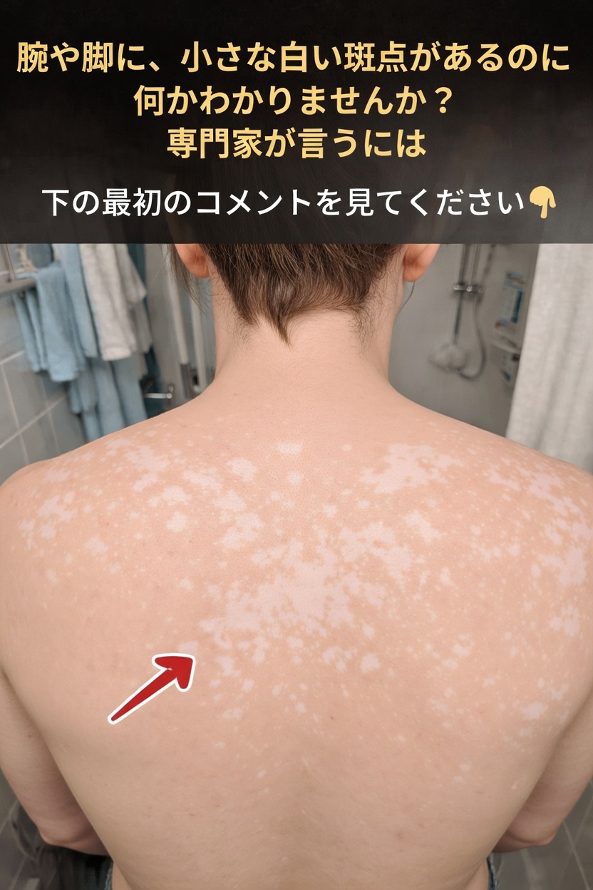 腕や脚にできる小さな白い斑点、その本当の意味とは?