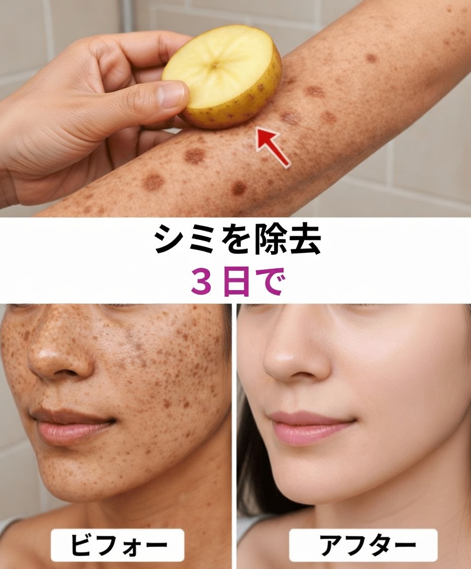 加齢によるシミ、肝斑、日焼けジミ、肌トラブル、エイジングサインを一掃