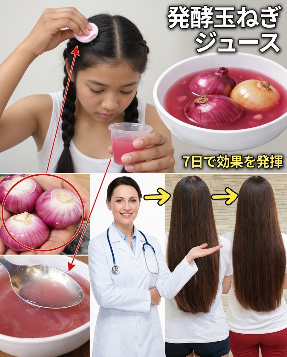 発酵玉ねぎジュース：より太く、強く、早く伸びる髪のための自然の秘訣