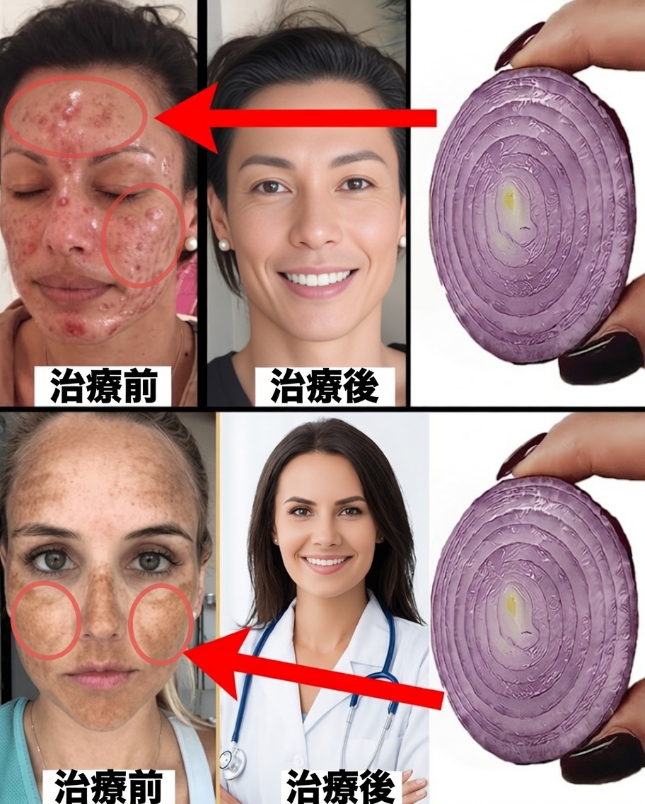 コーンスターチと玉ねぎを混ぜて雪のように白くガラスのように透明な肌へ：もっと早く知りたかった自然の秘密