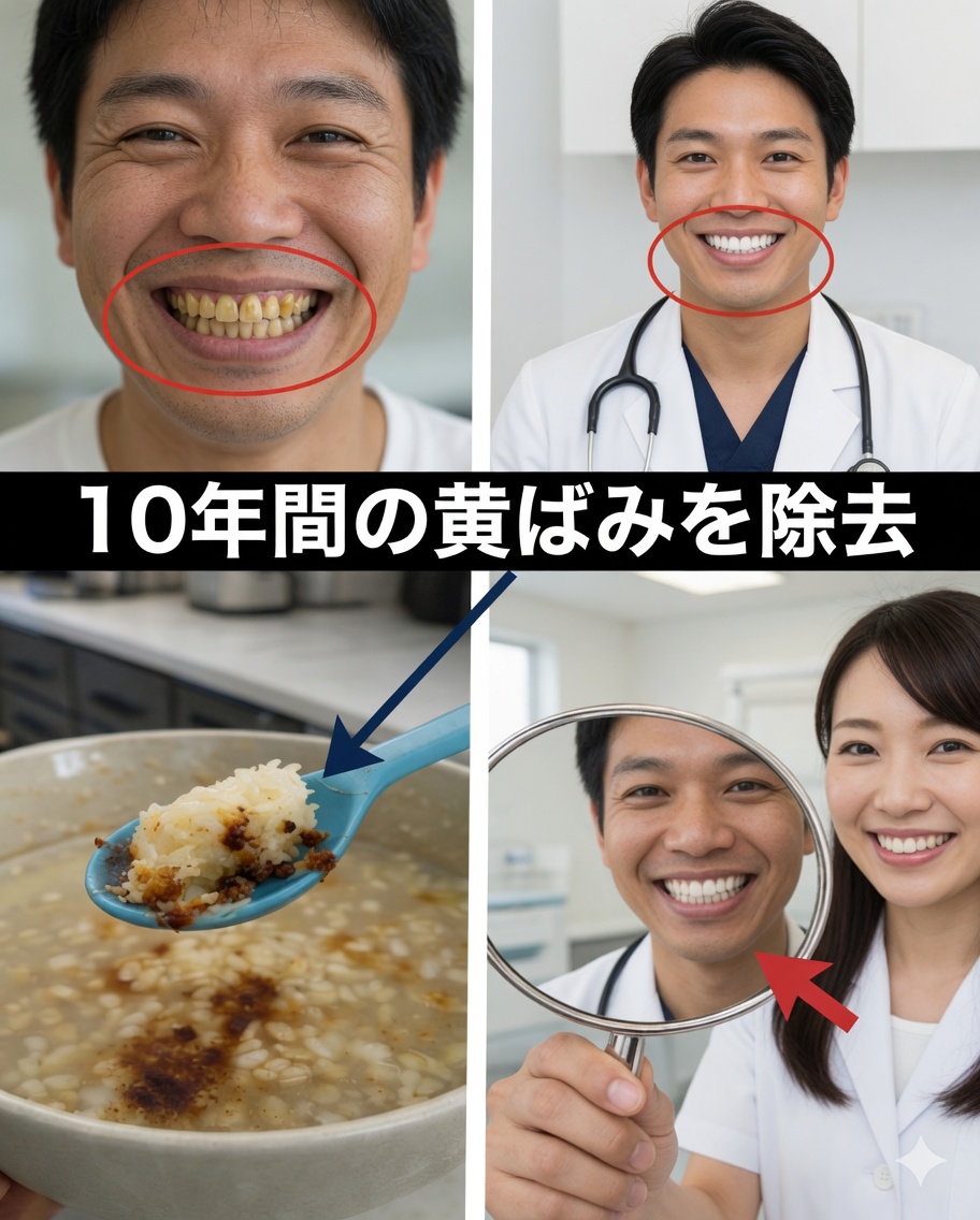 2分で歯の黄ばみが10年分消える？驚きの真実