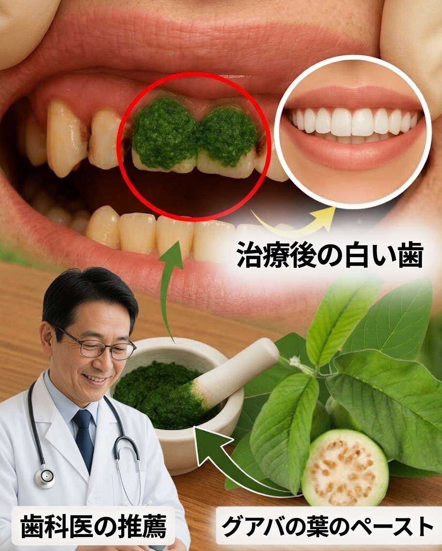 グアバの葉が虫歯と戦う3つの強力な方法