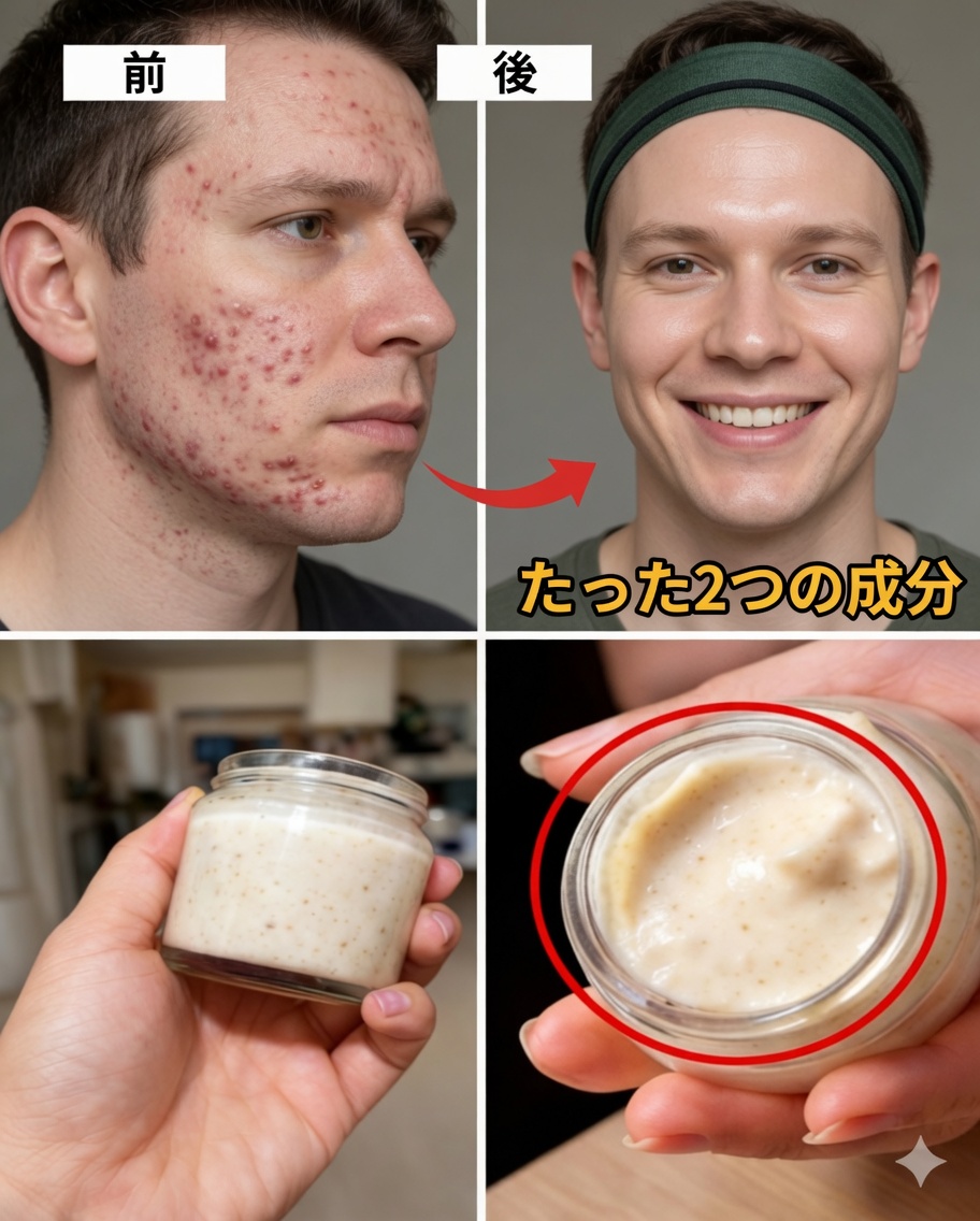 カバの皮を使って小じわを和らげ、肌を明るくする自然な7つの方法