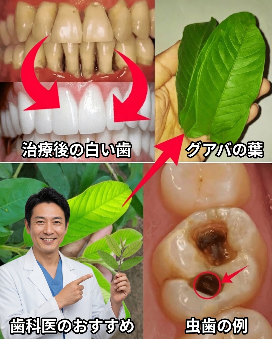 グアバの葉で虫歯を治すための簡単で経済的な3つの方法