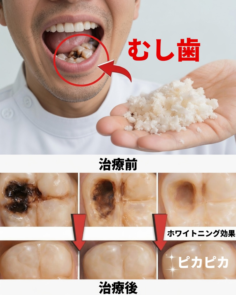 歯医者を避けるためにこれらの習慣を続けよう：初期の虫歯を自然に修復するために歯を助ける方法