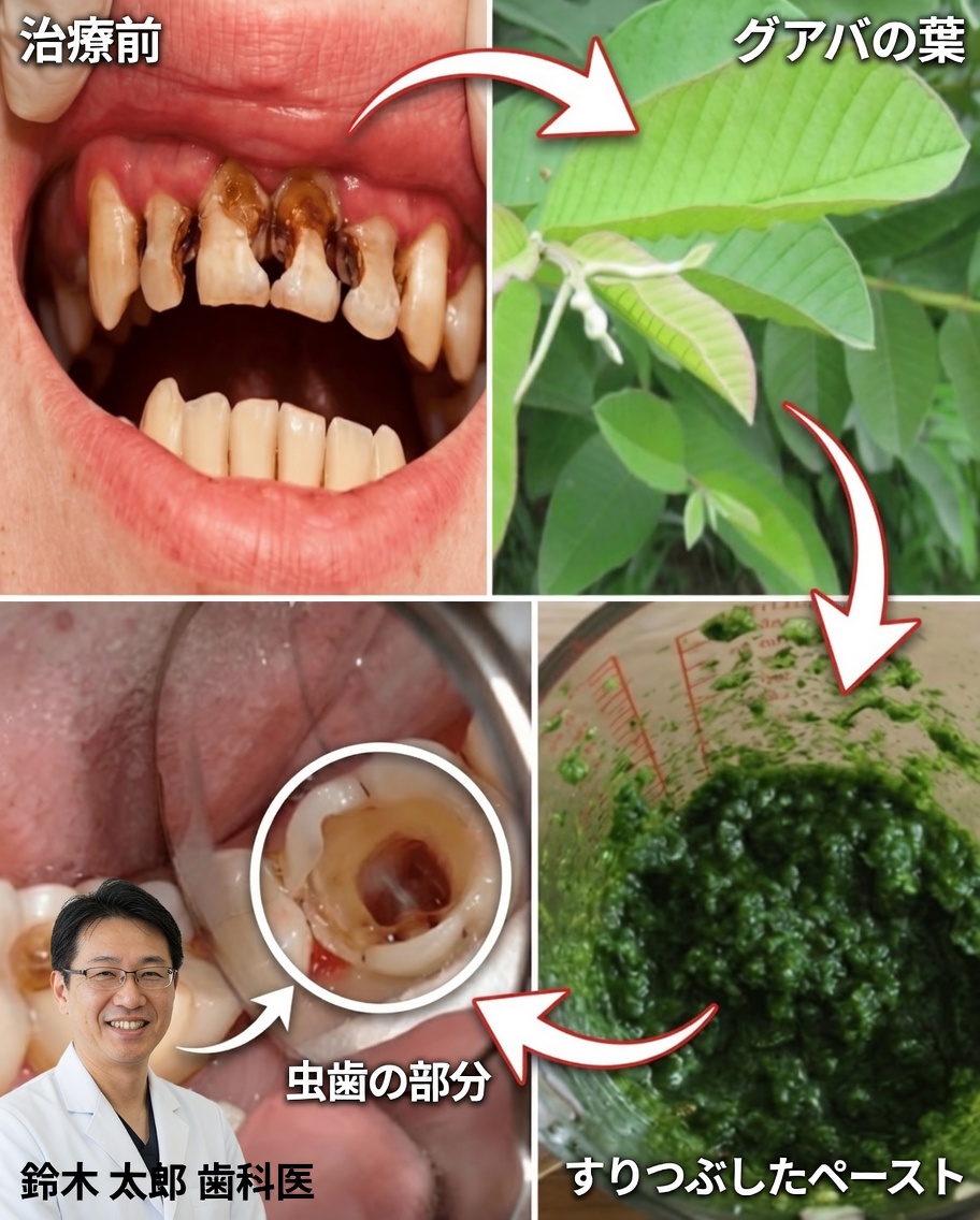 輝く笑顔のためのグアバの葉：70歳のおばあちゃんが伝えた自然派オーラルケアの秘訣